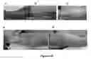 Fig. 19 - MULTIFUNCTIONAL COMPOSITE SKIN OR WOUND DRESSING AS REGENERATIVE SKIN SUBSTITUTE