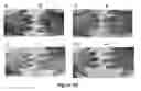 Fig. 20 - MULTIFUNCTIONAL COMPOSITE SKIN OR WOUND DRESSING AS REGENERATIVE SKIN SUBSTITUTE