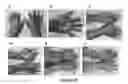 Fig. 24 - MULTIFUNCTIONAL COMPOSITE SKIN OR WOUND DRESSING AS REGENERATIVE SKIN SUBSTITUTE