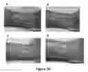 Fig. 27 - MULTIFUNCTIONAL COMPOSITE SKIN OR WOUND DRESSING AS REGENERATIVE SKIN SUBSTITUTE