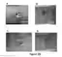Fig. 30 - MULTIFUNCTIONAL COMPOSITE SKIN OR WOUND DRESSING AS REGENERATIVE SKIN SUBSTITUTE