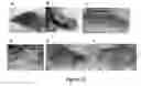 Fig. 32 - MULTIFUNCTIONAL COMPOSITE SKIN OR WOUND DRESSING AS REGENERATIVE SKIN SUBSTITUTE
