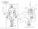 Fig. 01 - Method and system to protect kidneys during surgery