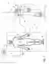 Fig. 02 - Method and system to protect kidneys during surgery