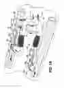Fig. 03 - Arteriovenous access valve system and process