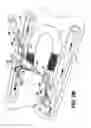 Fig. 04 - Arteriovenous access valve system and process