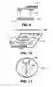 Fig. 10 - Arteriovenous access valve system and process