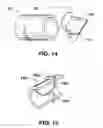 Fig. 13 - Arteriovenous access valve system and process
