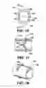 Fig. 14 - Arteriovenous access valve system and process