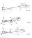 Fig. 12 - SEALED PACKAGES CONTAINING A MEDICAL DEVICE
