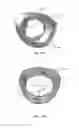 Fig. 30 - Medication administering device