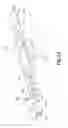 Fig. 16 - Low dose prefilled drug delivery device and method