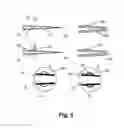 Fig. 04 - Electroformed Needle Cannula