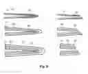 Fig. 07 - Electroformed Needle Cannula