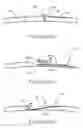Fig. 16 - User interface and system for supplying gases to an airway