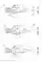 Fig. 10 - Intubating endoscopic device