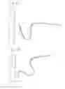 Fig. 12 - STEERABLE ENDOLUMINAL DEVICES AND METHODS