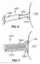 Fig. 05 - Devices, systems, and methods useful to engage tissue using suction and to perform medical procedures during suctional engagement