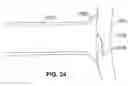 Fig. 15 - Devices, systems, and methods useful to engage tissue using suction and to perform medical procedures during suctional engagement