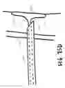 Fig. 17 - Devices, systems, and methods useful to engage tissue using suction and to perform medical procedures during suctional engagement