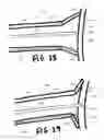 Fig. 20 - Devices, systems, and methods useful to engage tissue using suction and to perform medical procedures during suctional engagement