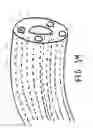 Fig. 23 - Devices, systems, and methods useful to engage tissue using suction and to perform medical procedures during suctional engagement