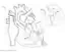 Fig. 01 - INJECTION CATHETER