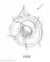 Fig. 07 - Steering actuator for deflectable catheter