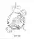Fig. 16 - Steering actuator for deflectable catheter