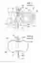 Fig. 02 - Offset catheter securement device with removable retention member