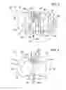 Fig. 03 - Offset catheter securement device with removable retention member