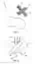 Fig. 06 - Offset catheter securement device with removable retention member
