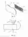 Fig. 09 - Offset catheter securement device with removable retention member