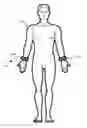 Fig. 01 - Systems and methods for electrostimulation therapy