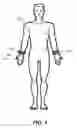 Fig. 02 - Systems and methods for electrostimulation therapy