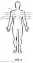 Fig. 03 - Systems and methods for electrostimulation therapy