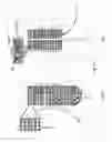 Fig. 18 - Apparatus and method for treating multiple tumors in patients with metastatic disease by electric fields