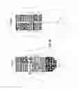 Fig. 23 - Apparatus and method for treating multiple tumors in patients with metastatic disease by electric fields
