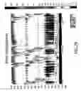 Fig. 30 - Device and implantation system for electrical stimulation of biological systems