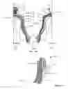 Fig. 32 - Systems and methods for using a transcutaneous electrical stimulation device to deliver titrated therapy