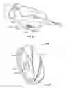 Fig. 42 - Systems and methods for using a transcutaneous electrical stimulation device to deliver titrated therapy