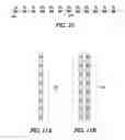 Fig. 07 - Anatomical targeting of neuromodulation