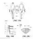 Fig. 14 - Anatomical targeting of neuromodulation