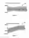 Fig. 05 - Onset-mitigating high-frequency nerve block