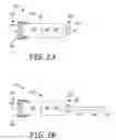 Fig. 03 - Atrial tracking in an intracardiac ventricular pacemaker