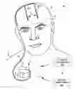 Fig. 01 - Brain stimulation programming