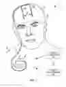 Fig. 02 - Brain stimulation programming