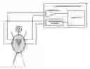 Fig. 01 - Method and device for treating cardiac arrhythmias