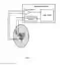 Fig. 02 - Method and device for treating cardiac arrhythmias