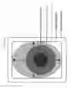 Fig. 07 - BRACHYTHERAPY APPLICATOR WITH RADIATION SENSORS